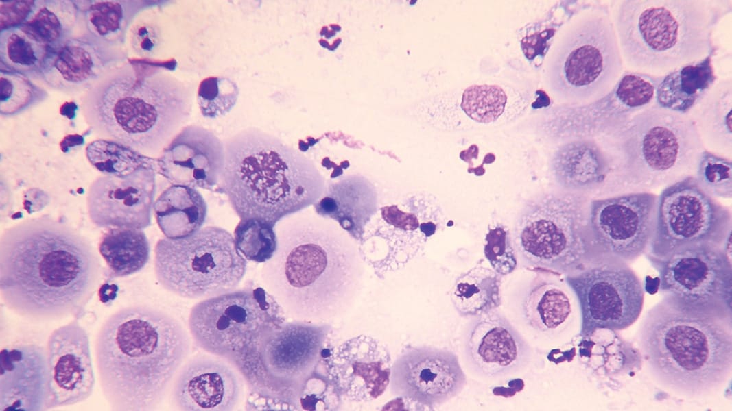 Oral Smear Cytology